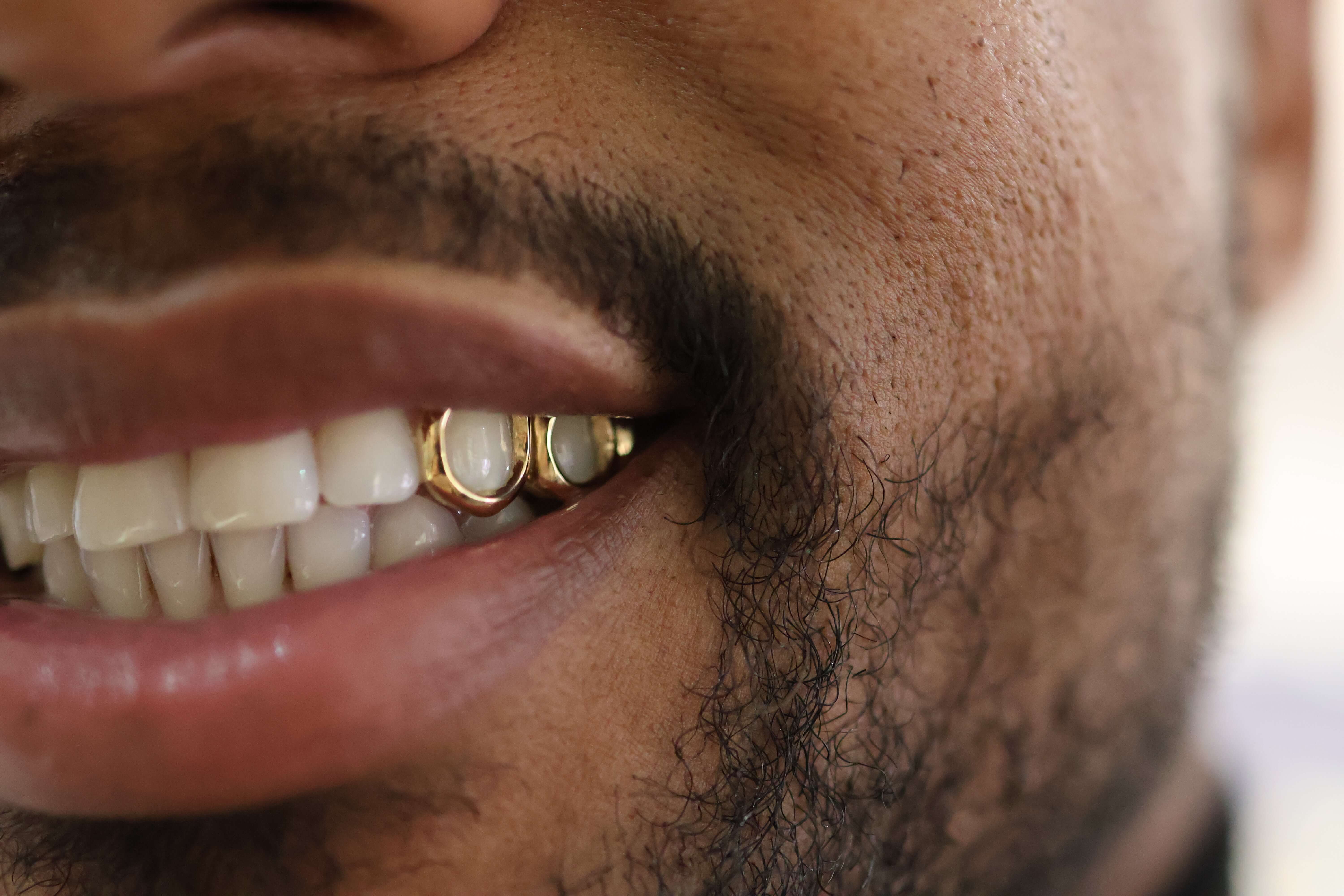 14K Solid Yellow Gold grillz